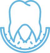 sluzby-osetreni-kanalku